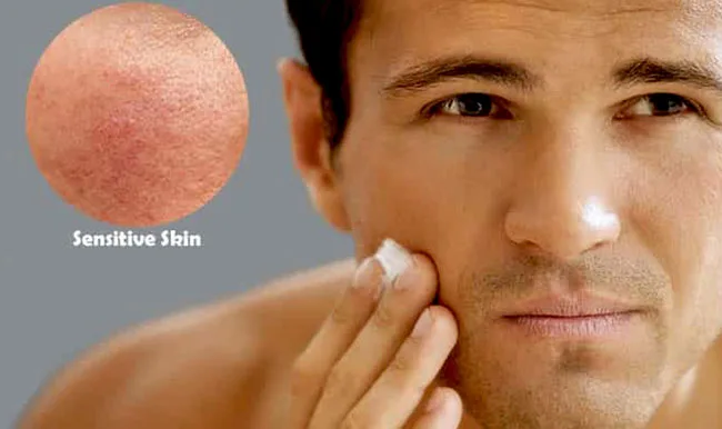 Understanding sensitive skin